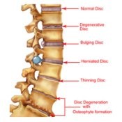 MRI Review