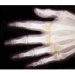 Sure Quality X-Ray Film