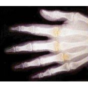 Sure Quality X-Ray Film